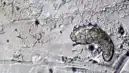 Yüzünüzde Yaşayan Minik Canlılar: Demodex Akarları