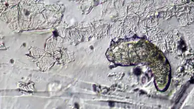 Yüzünüzde Yaşayan Minik Canlılar: Demodex Akarları