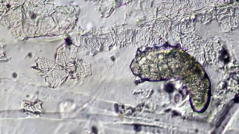Yüzünüzde Yaşayan Minik Canlılar: Demodex Akarları